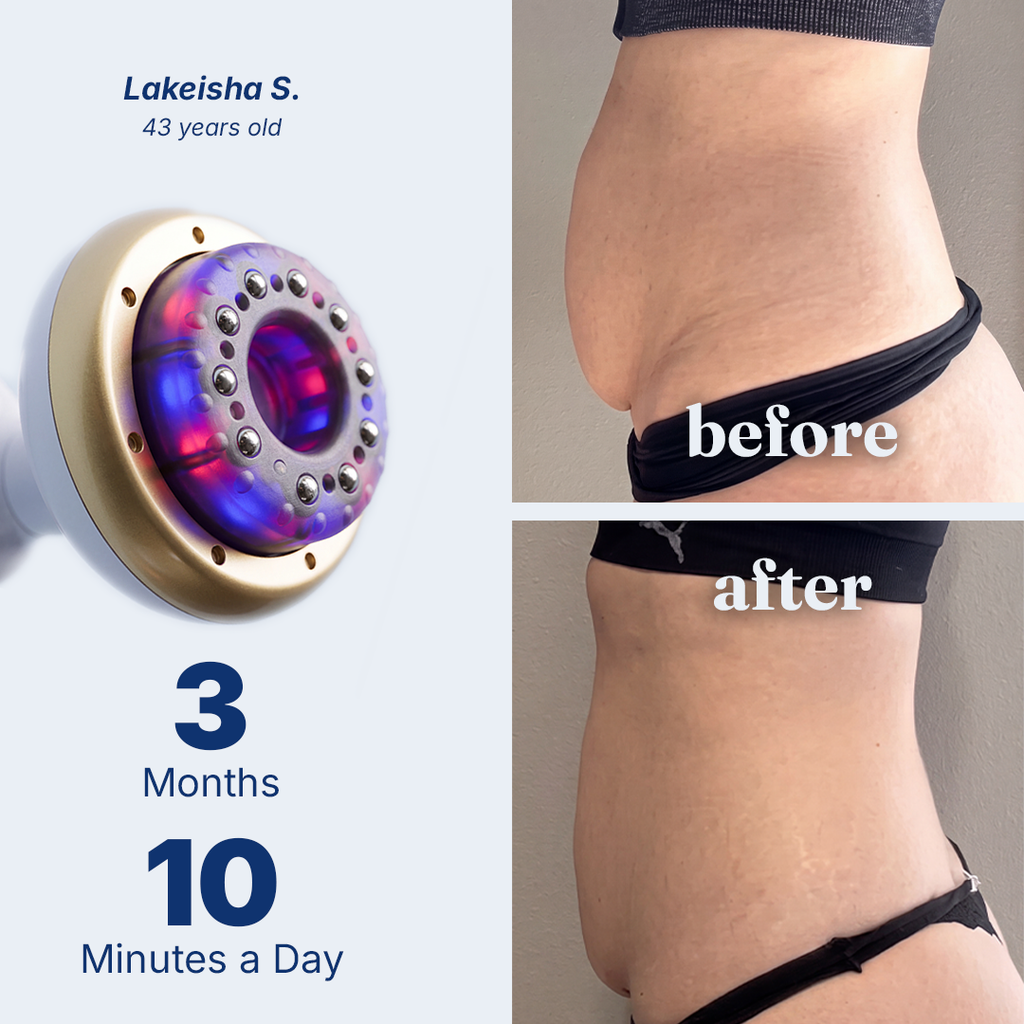 Body Massager with Suction, Heat & Red Light