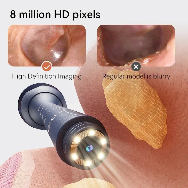1080P HD Ear Cleaning Camera with 14-Piece Tool Kit